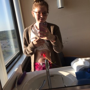 My current feeding tube, Peggy the PEG-J